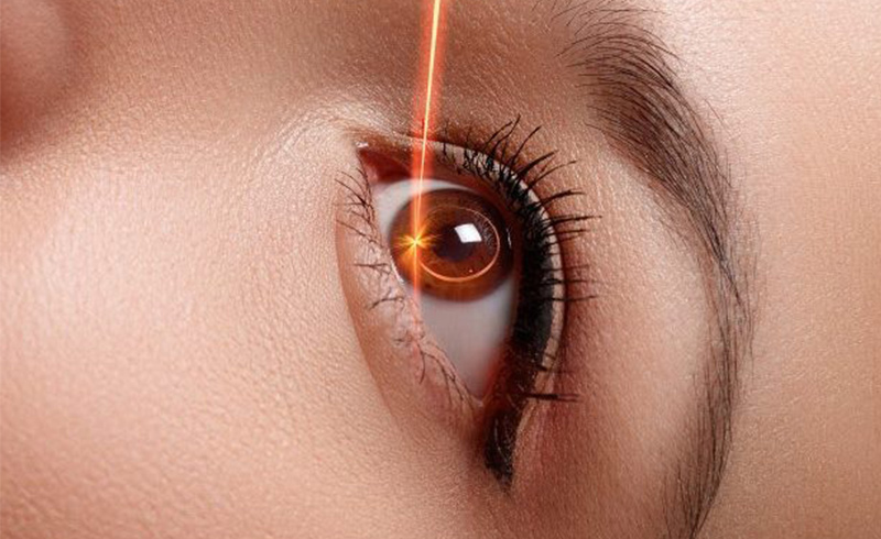 Myths about LASIK treatment