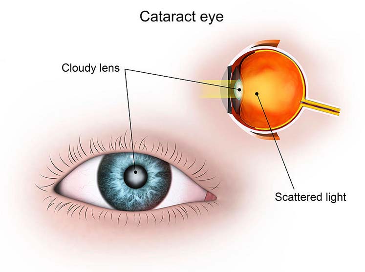 eye doctor in dubai