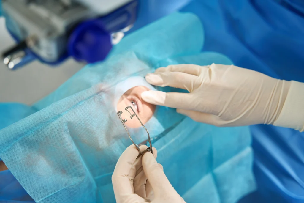 What is the 20 20 20 rule after LASIK?